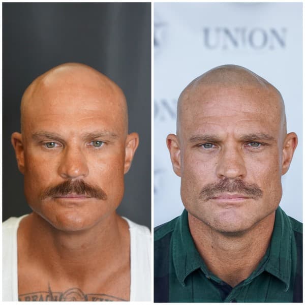 Density Enhancement Before and After